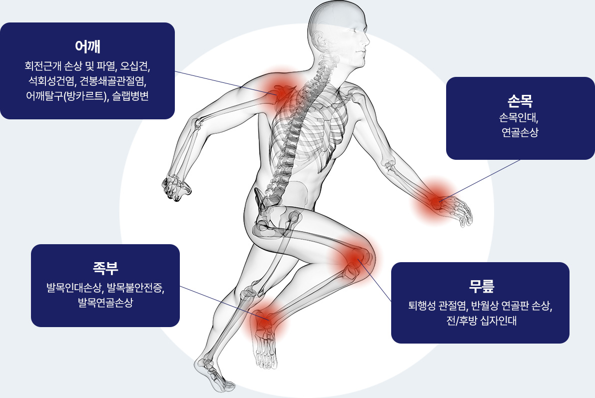 어깨 - 회전근개 손상 및 파열, 오십견, 석회성건염, 견봉쇄골관절염, 어깨탈구(방카르트), 슬랩병변 / 손목 - 손목인대, 연골손상 / 족부 - 발목인대손상, 발목불안전증, 발목연골손상 / 무릎 - 퇴행성 관절염, 반월상 연골판 손상, 전/후방 십자인대